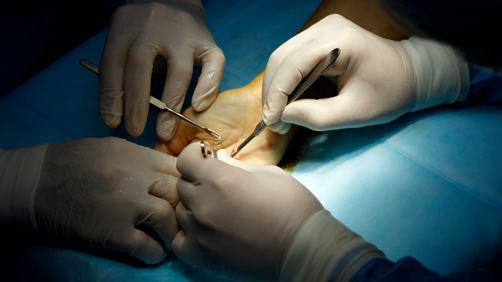 Handchirurgie - Verstehen Sie Ihre Träume - Kaya